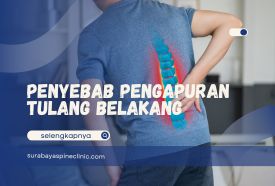 Penyebab Pengapuran Tulang Belakang, Kenali Sebab dan Pengobatannya
